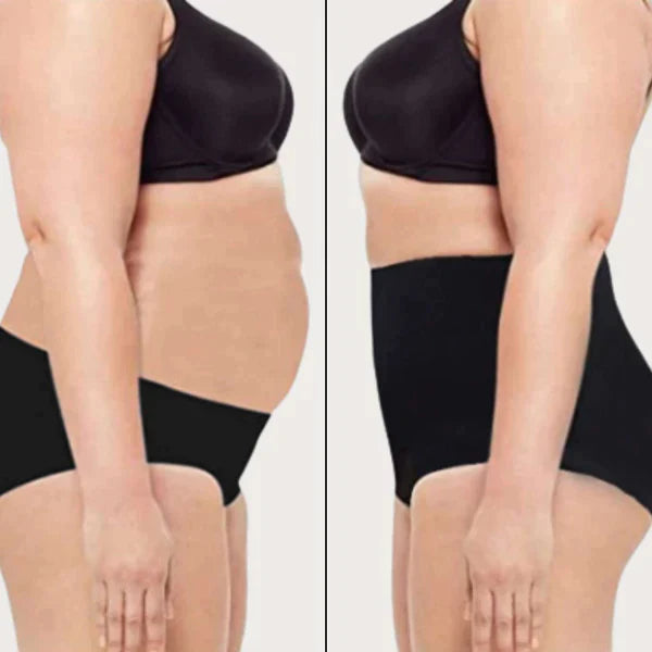 TUMMY TUCK - Schummeln erlaubt