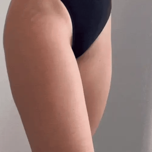 TUMMY TUCK - Schummeln erlaubt